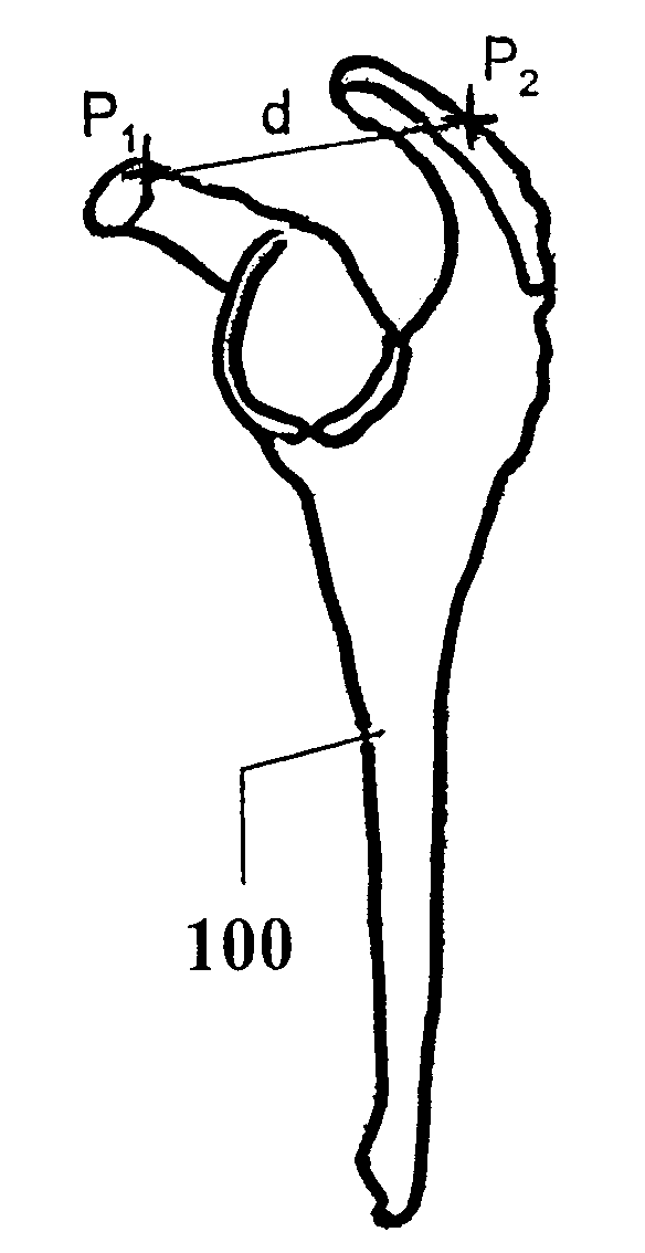 Determining correspondence object pairs for medical navigation