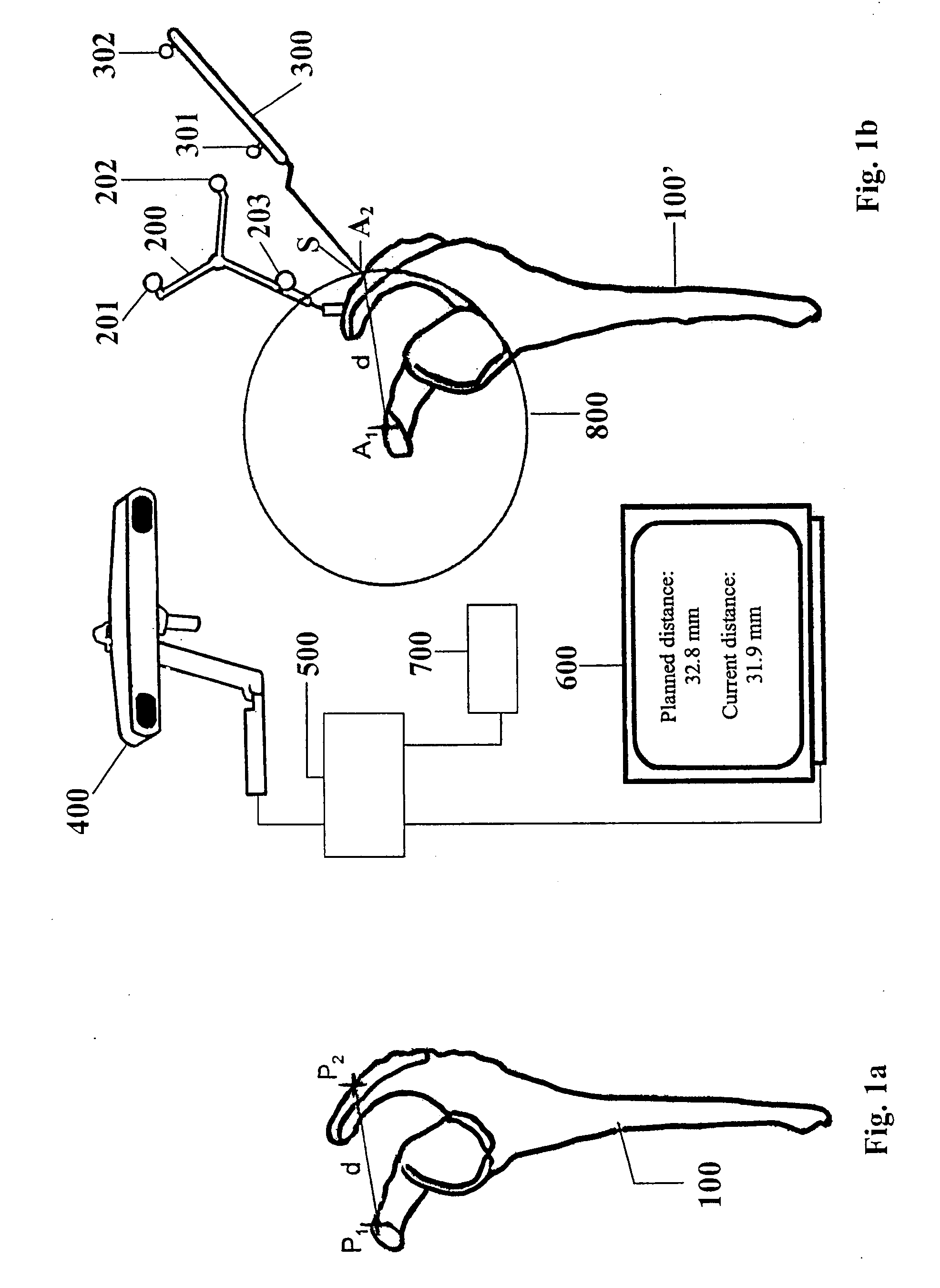 Determining correspondence object pairs for medical navigation