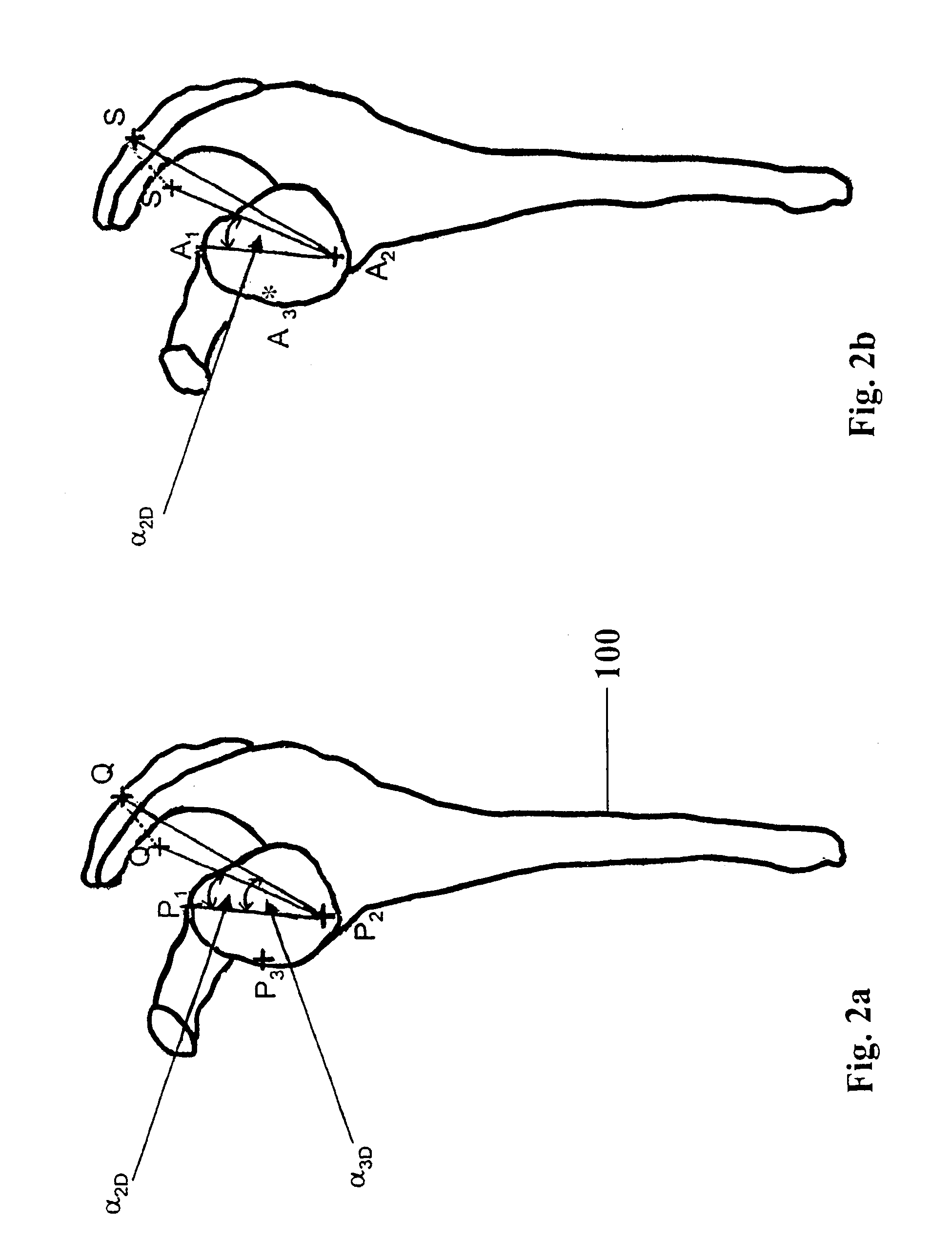 Determining correspondence object pairs for medical navigation