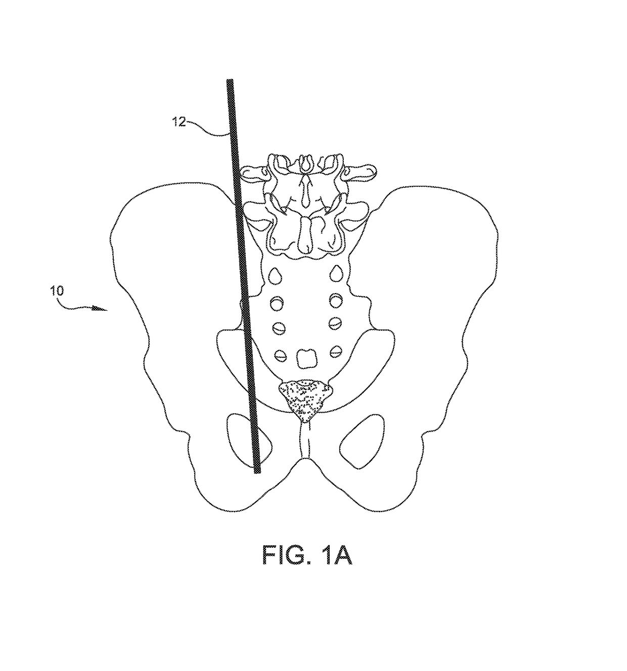 Tool and method for implanting fusion device into sacroiliac joint