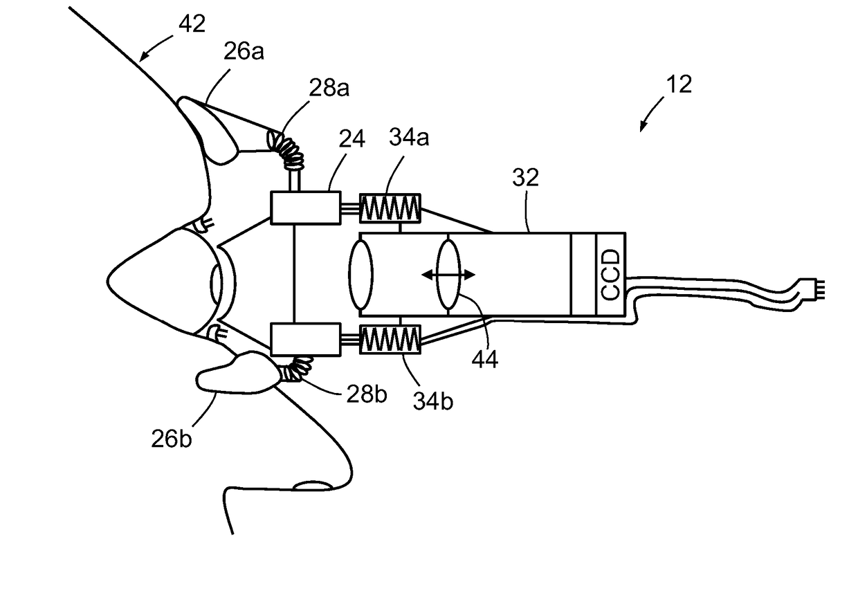 Method and System for Determining Intracranial Pressure