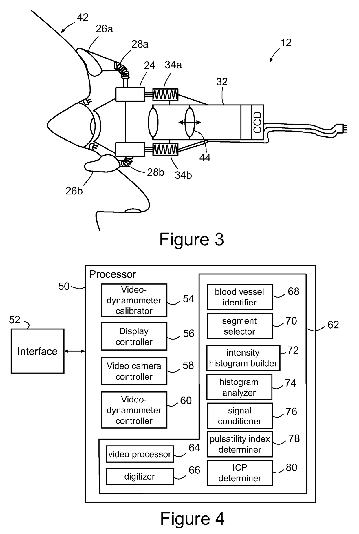 Method and System for Determining Intracranial Pressure