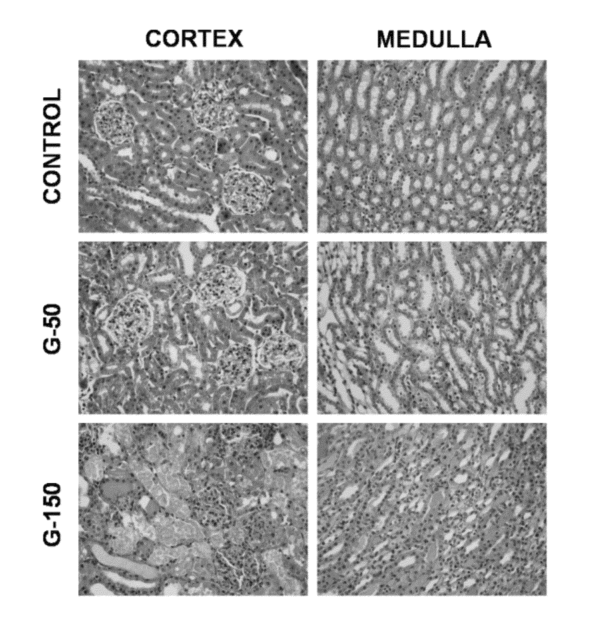 Urinary gm2 activator protein as a marker of acute renal failure or the risk of developing acute renal failure