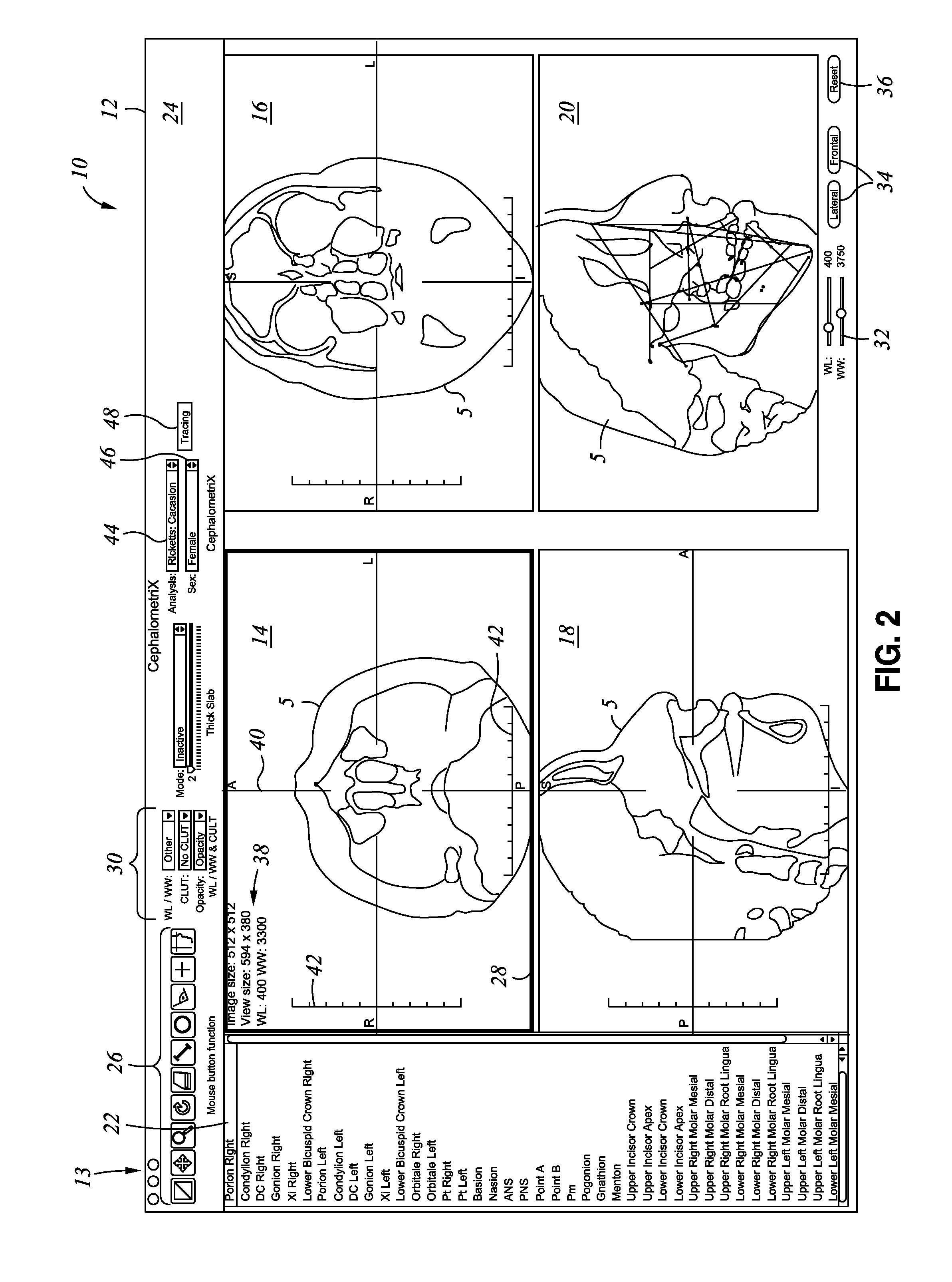 Method and system for orthodontic diagnosis