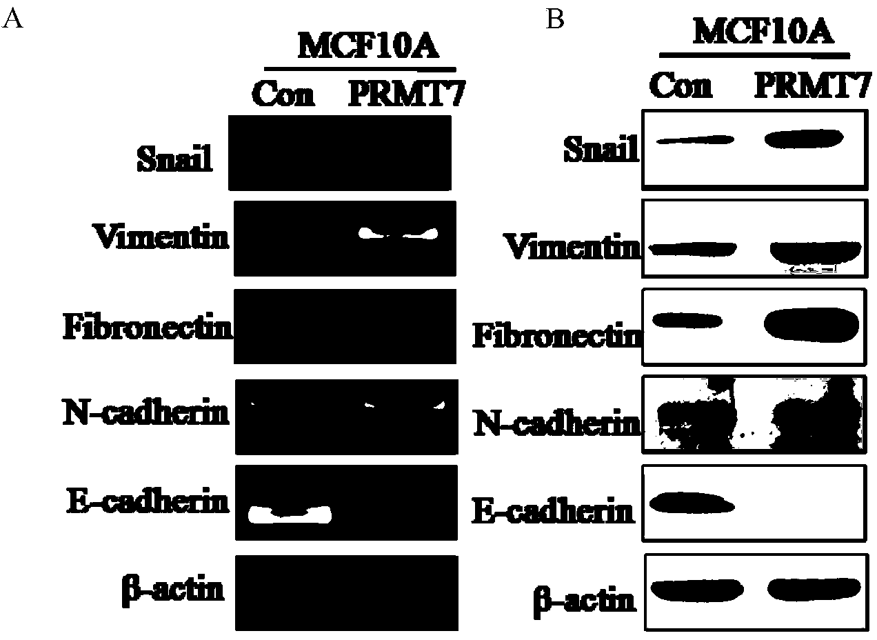 Application of protein arginine methyltransferase 7 in cancer cell metastasis