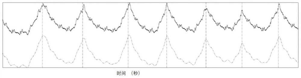 Breathing pattern detection method, device, processing equipment and system