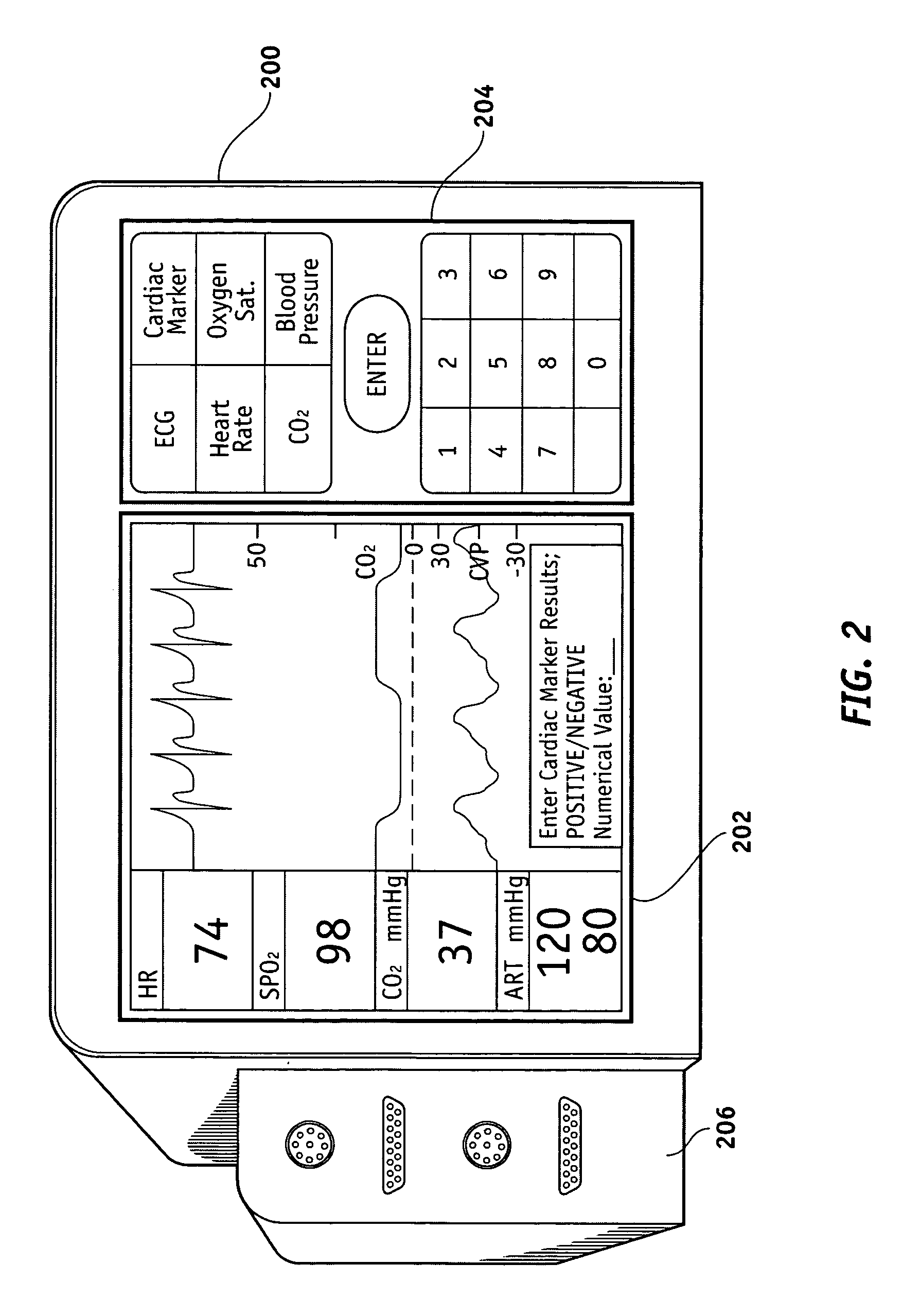 Apparatus and methods for documenting myocardial ischemia