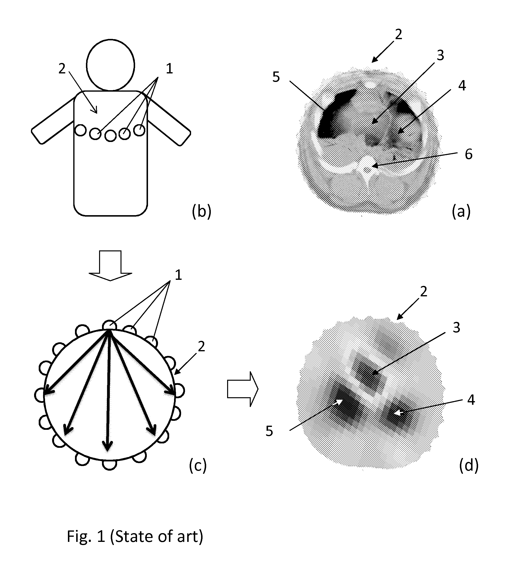 Method and Apparatus for the Non-Invasive Measurement of Pulse Transit Times (PTT)