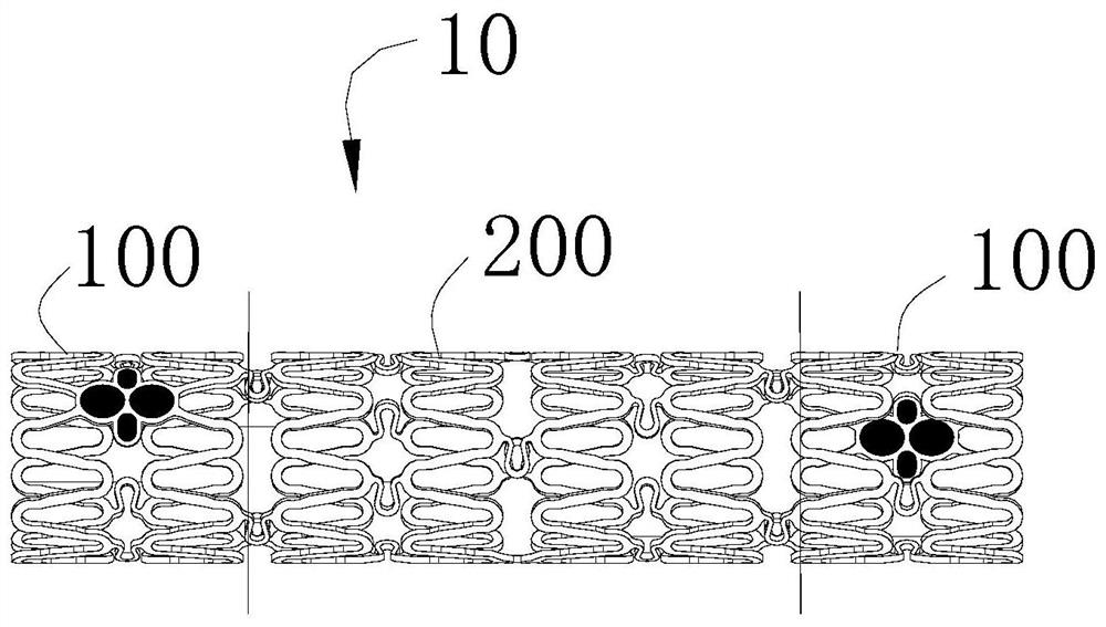 Absorbable peripheral stent and preparation method thereof