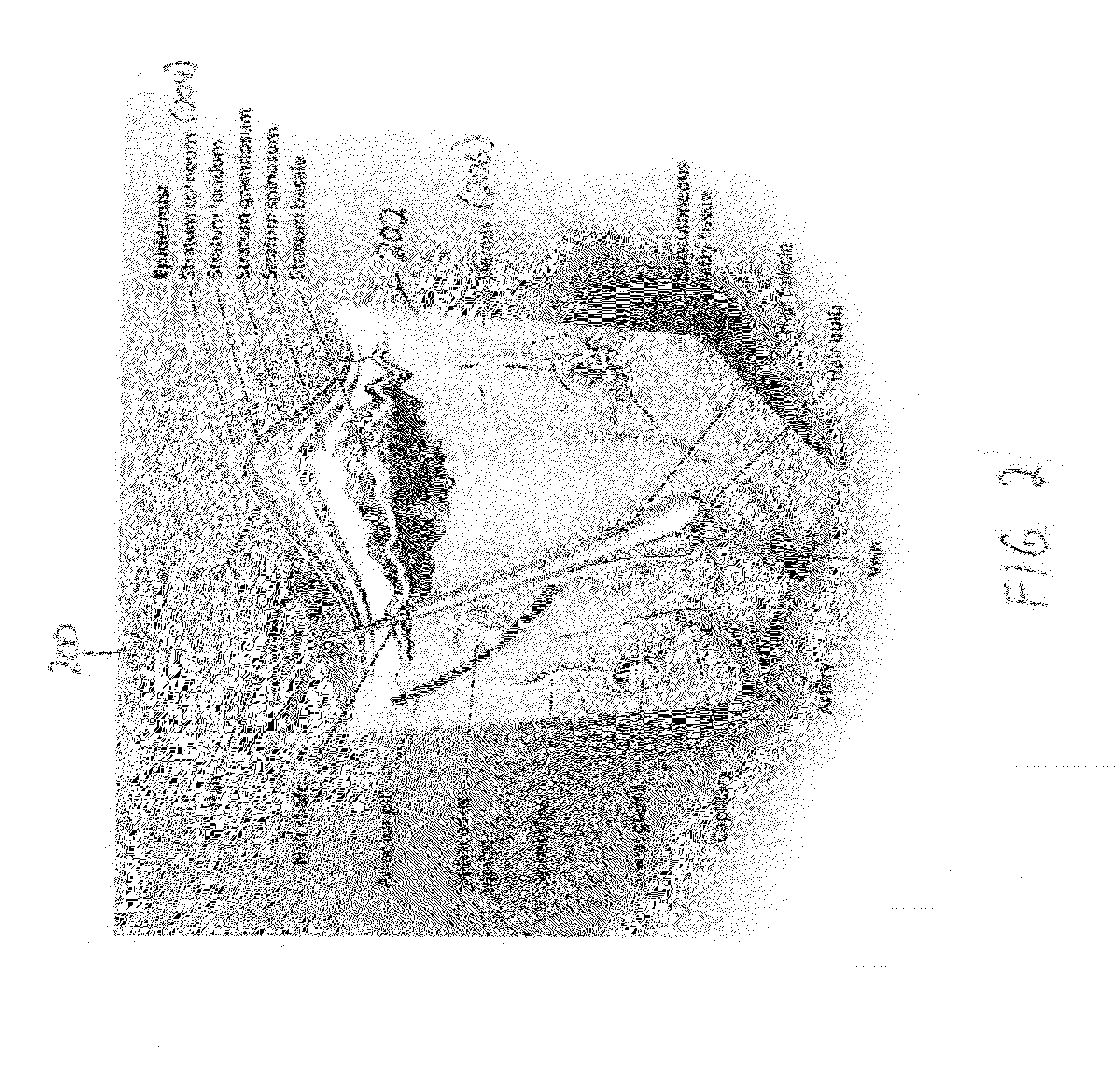 Touch interface device having an electrostatic multitouch surface and method for controlling the device