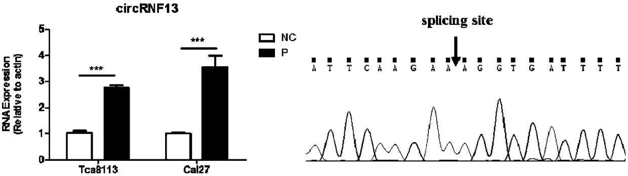 Application of reagent for detecting cyclic RNA circRNF13 in preparing prognosis preparation for tongue squamous cell carcinoma patients