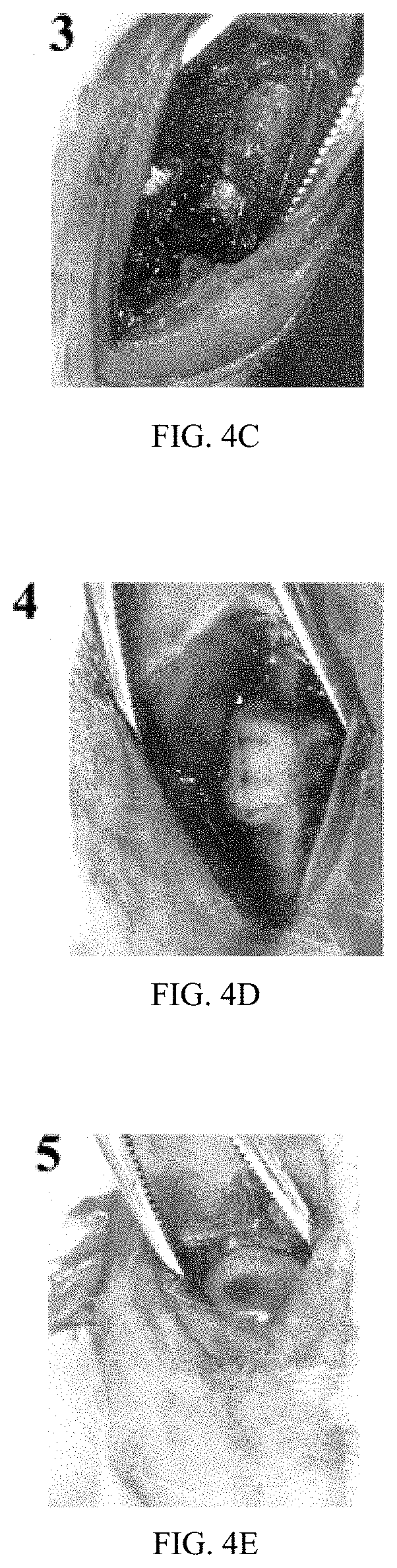 Absorbable bone wax having function of promoting bone repair and preparation method thereof