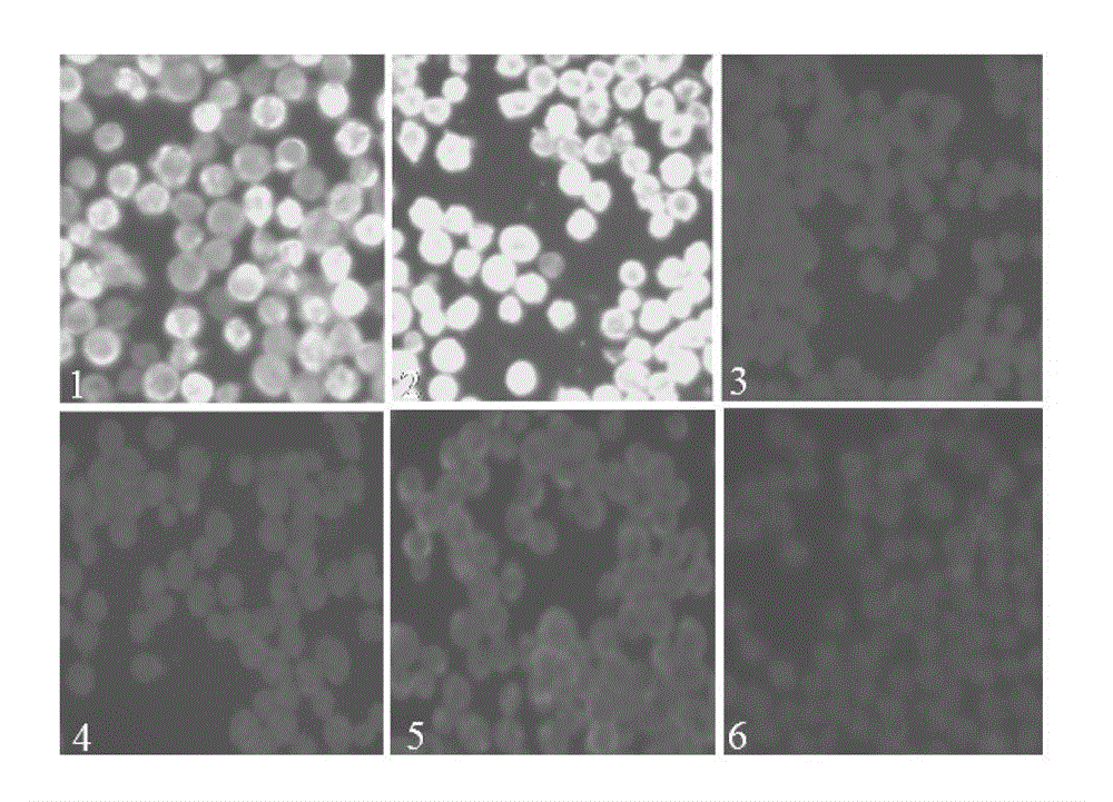 Monoclonal antibody against Eastern Equine Encephalitis Virus e2 protein (eeev-5e4) and its recognized B-cell epitope polypeptide and application