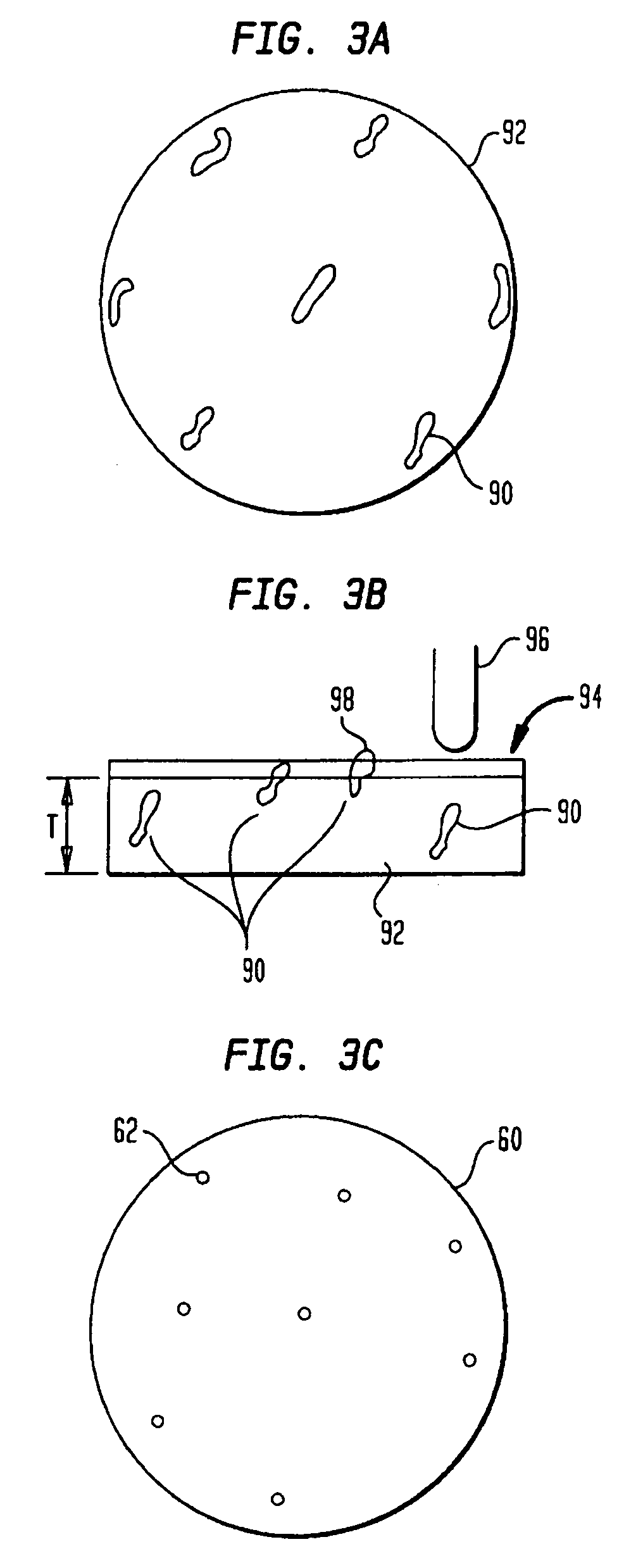 Method for fabricating a medical component from a material having a high carbide phase and such medical component