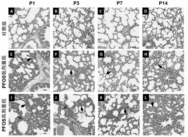 Application of perfluorooctane sulfonate in establishing bronchial pulmonary dysplasia animal model