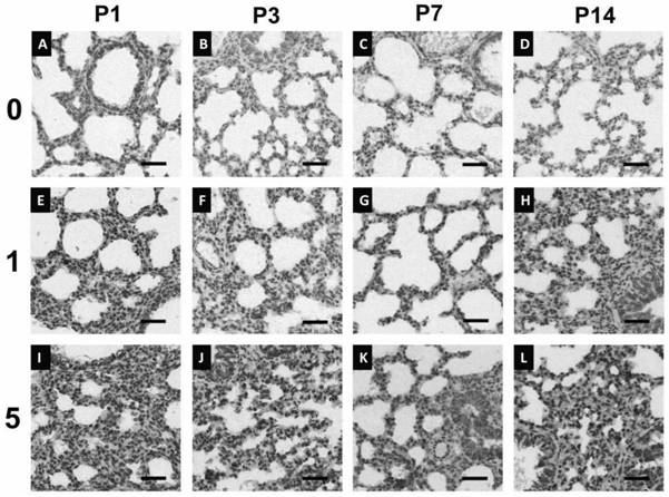 Application of perfluorooctane sulfonate in establishing bronchial pulmonary dysplasia animal model