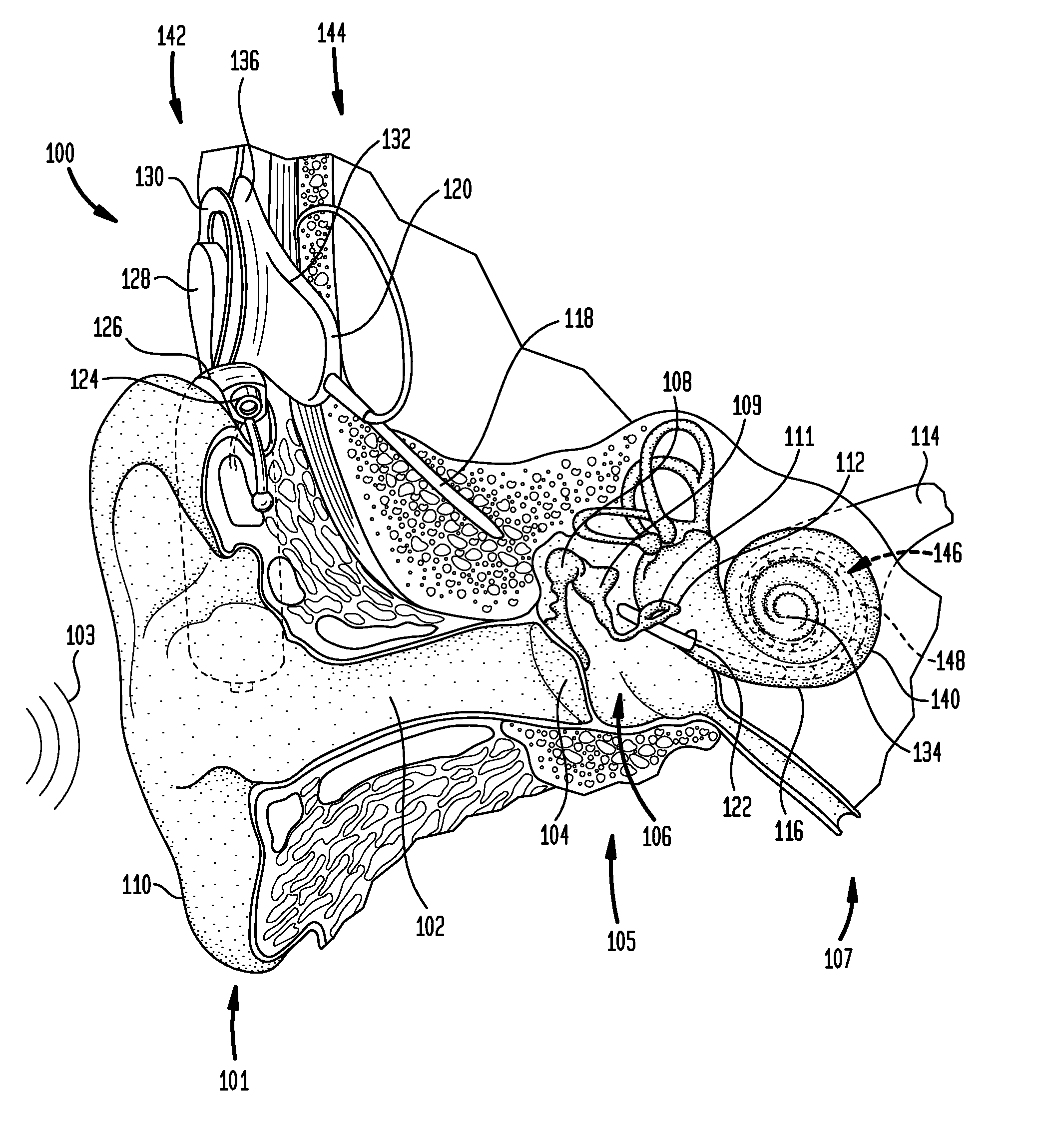 Electroneural interface for a medical implant