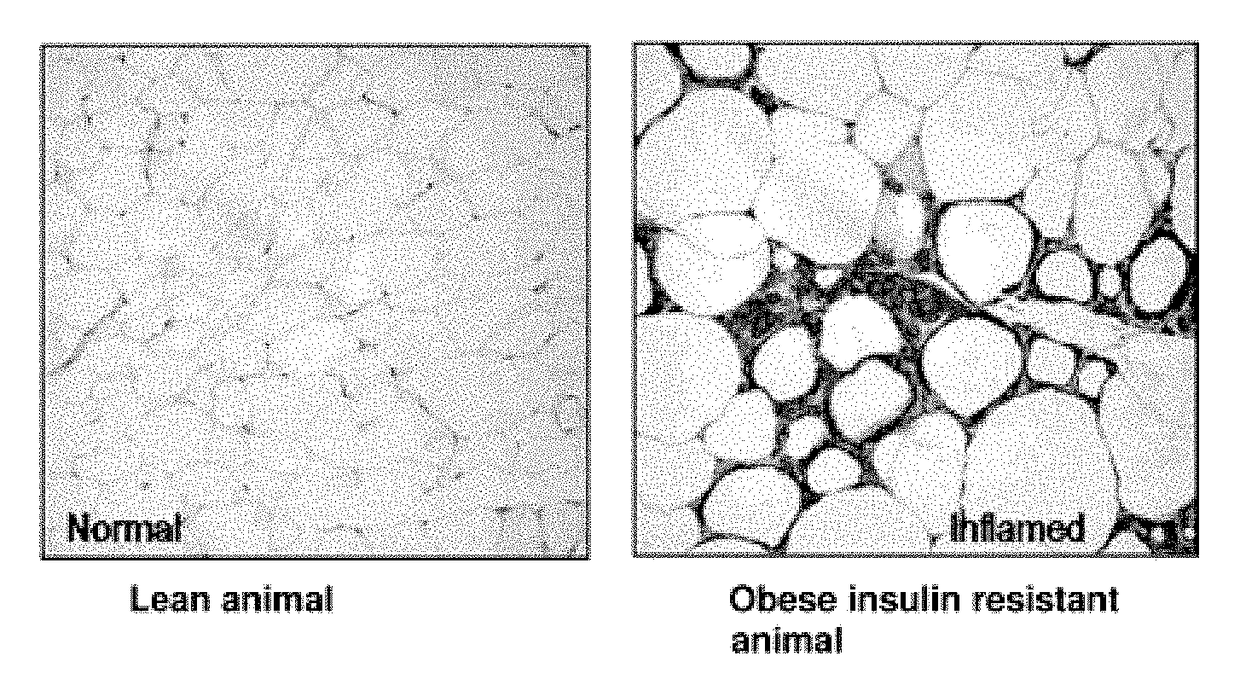 Formulations and methods for treatment of metabolic syndrome