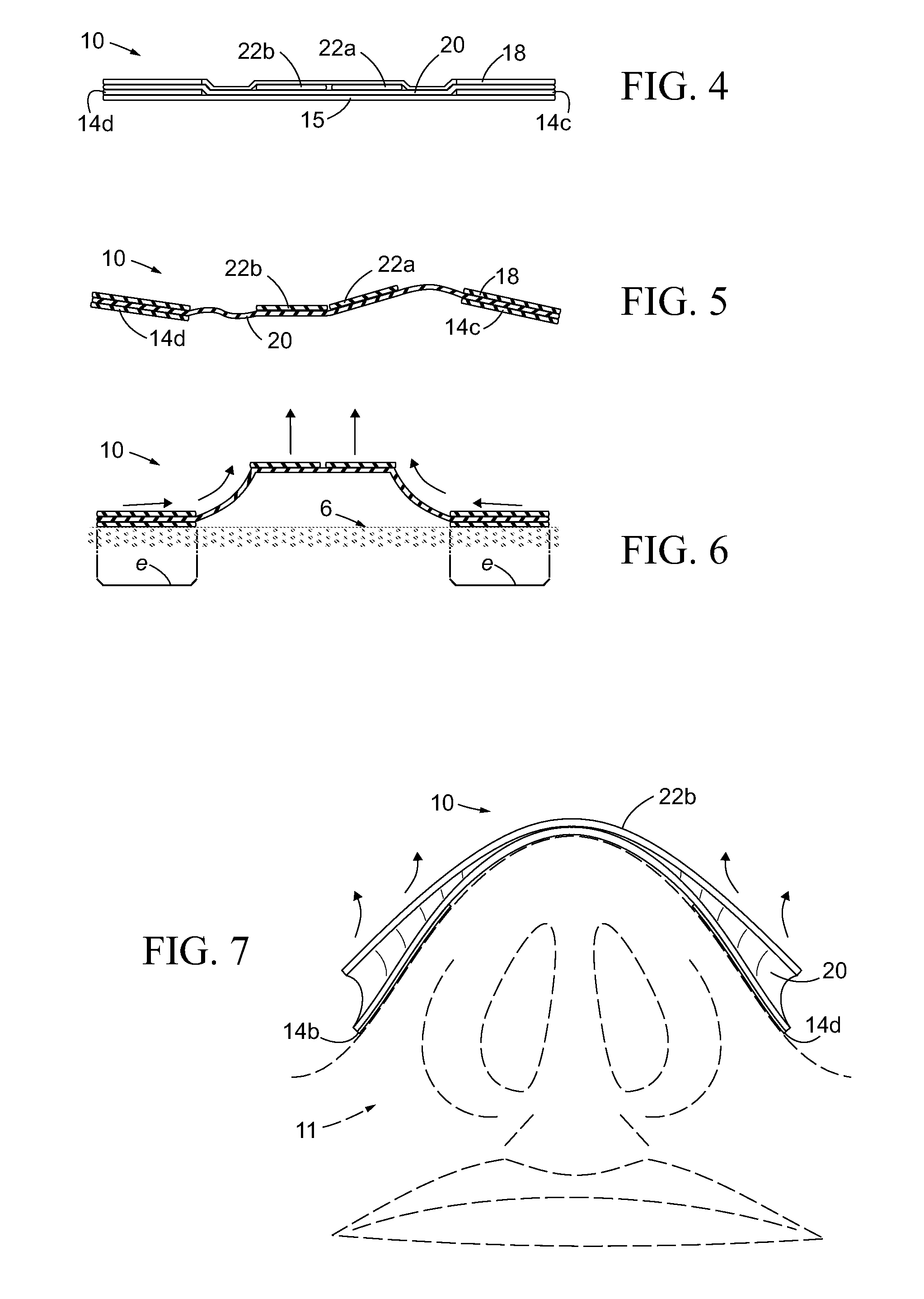 Nasal Dilator with Elastic Membrane Structure