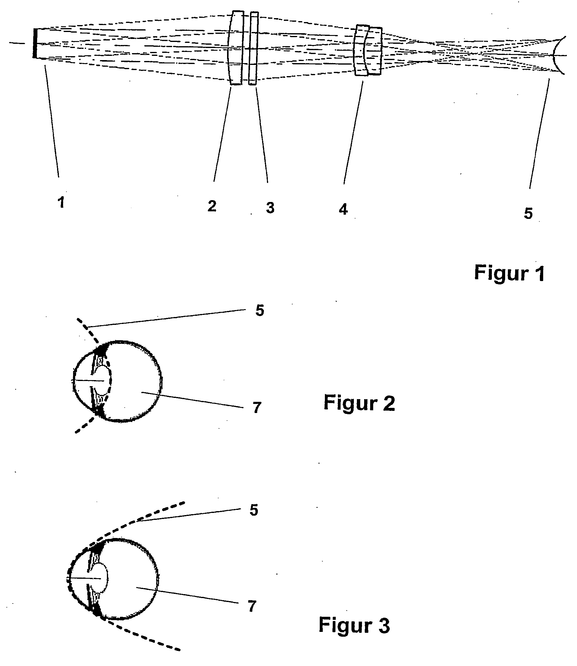 Arrangement for improving the image field in ophthalmological appliances