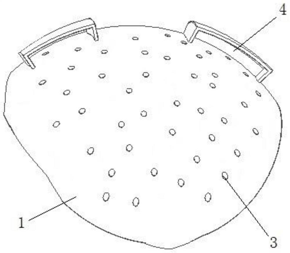 A 3D printed skull craniectomy bone window protection device after decompressive surgery and its preparation method