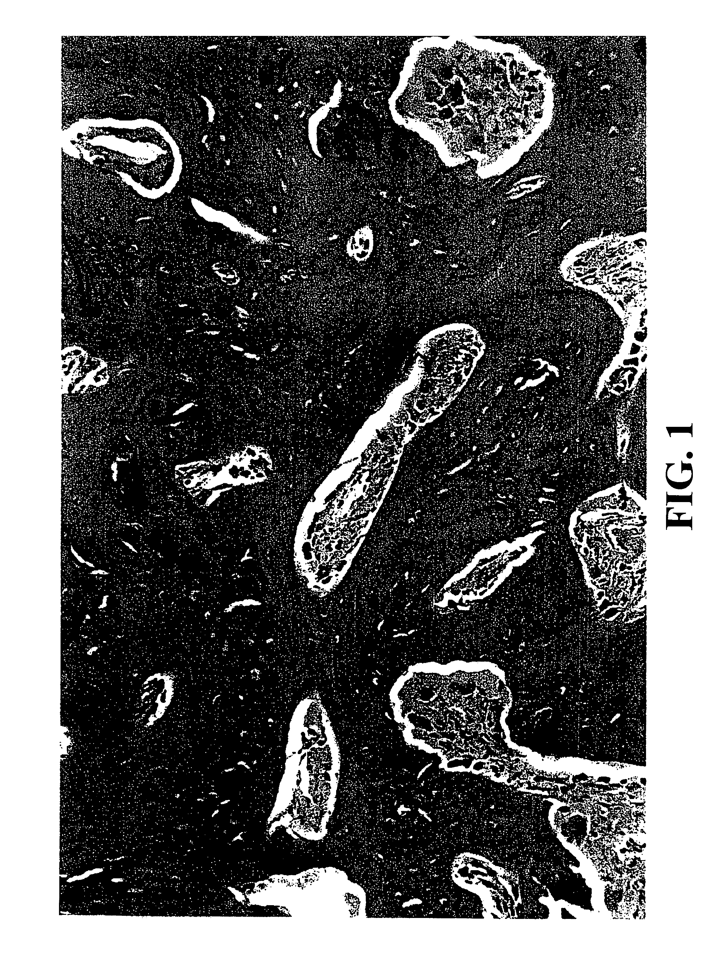 Transplantable particulate bone composition having high osteoinductive capacity and methods for making and using same