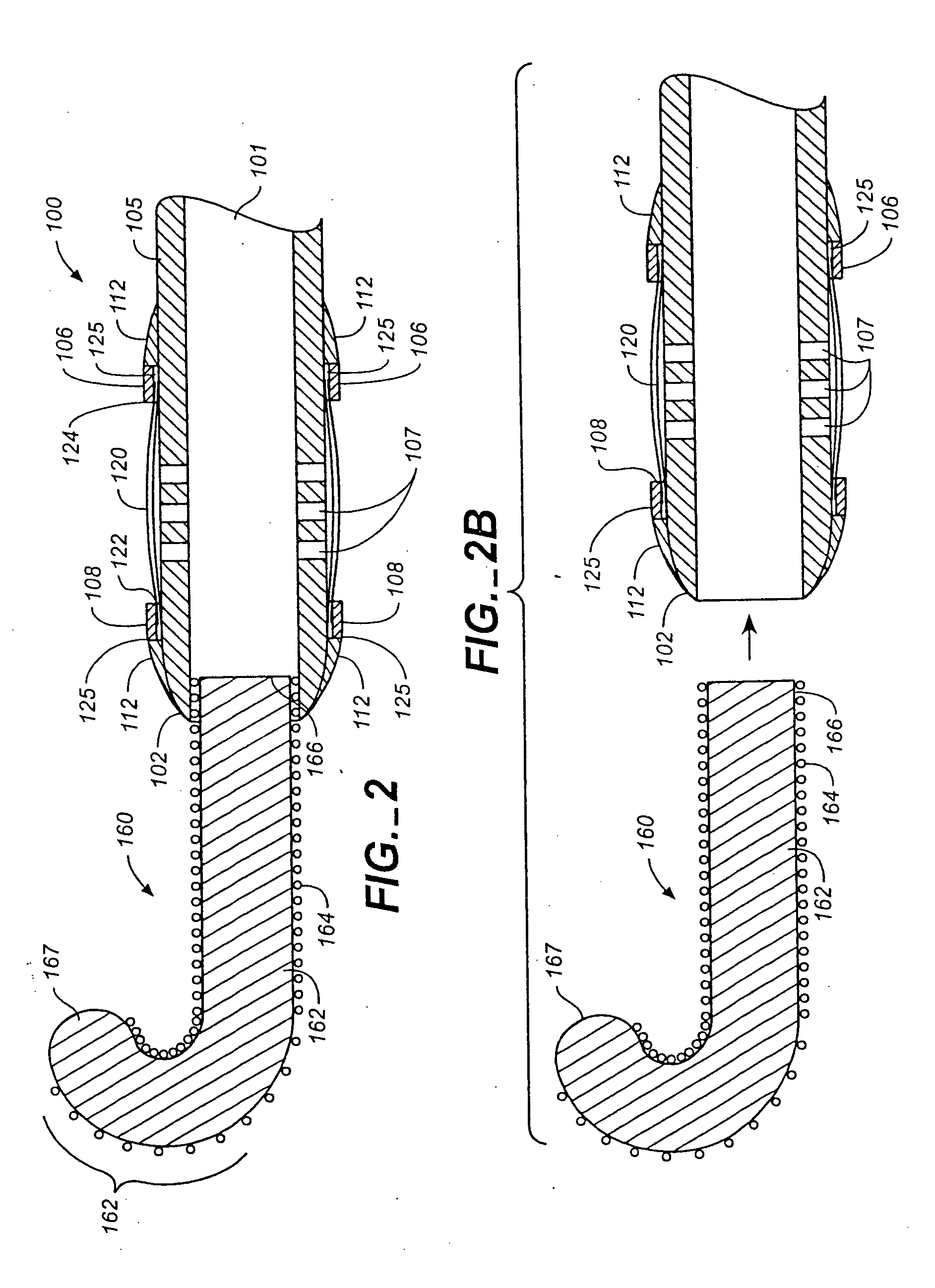 Balloon occlusion device having a proximal valve