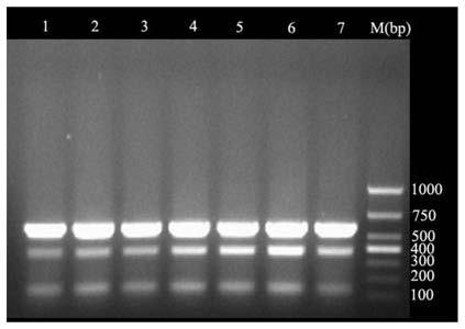 A multiple PCR detection kit for diagnosing poultry tuberculosis and its detection method