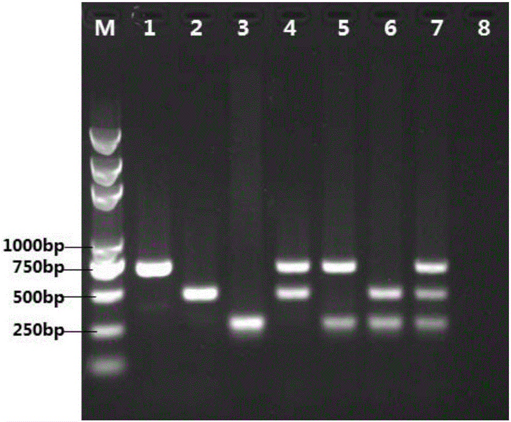 Multiple PCR detection primers of escherichia coli, pseudomonas aeruginosa and staphylococcus aureus, kit and detection method