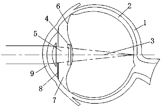 Novel intraocular lens system