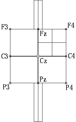 Square paper type electrode positioning method for newborn baby