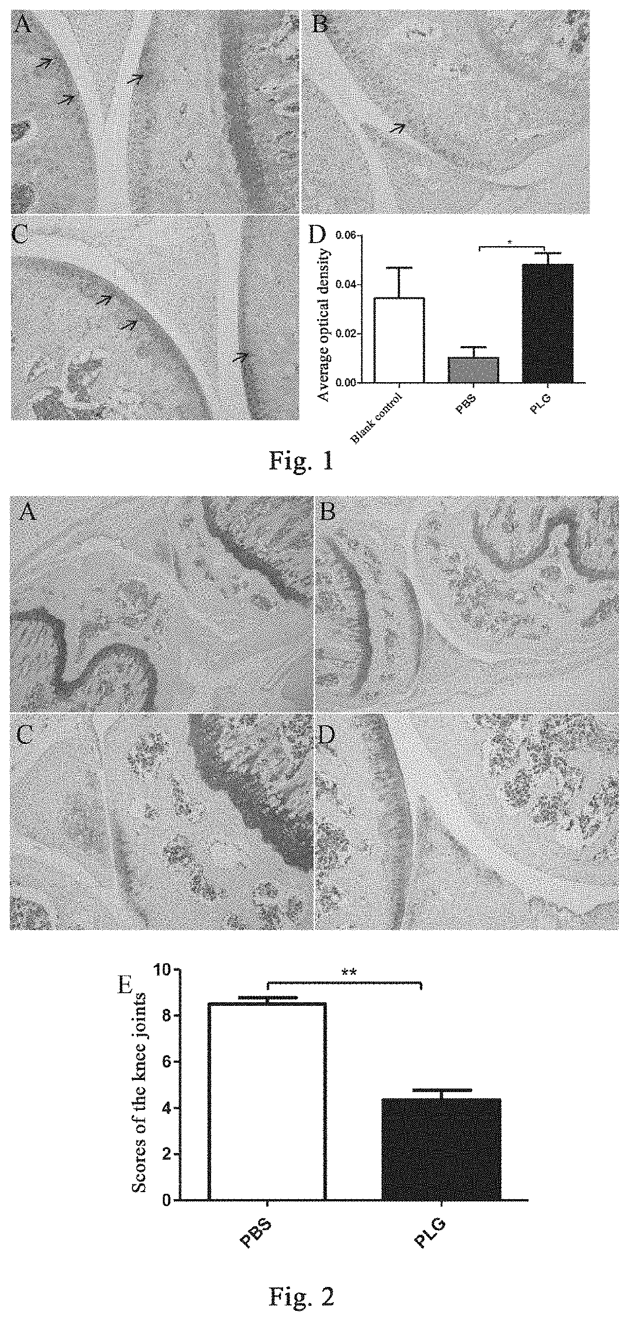 Method and drug for preventing or treating osteoarthritis