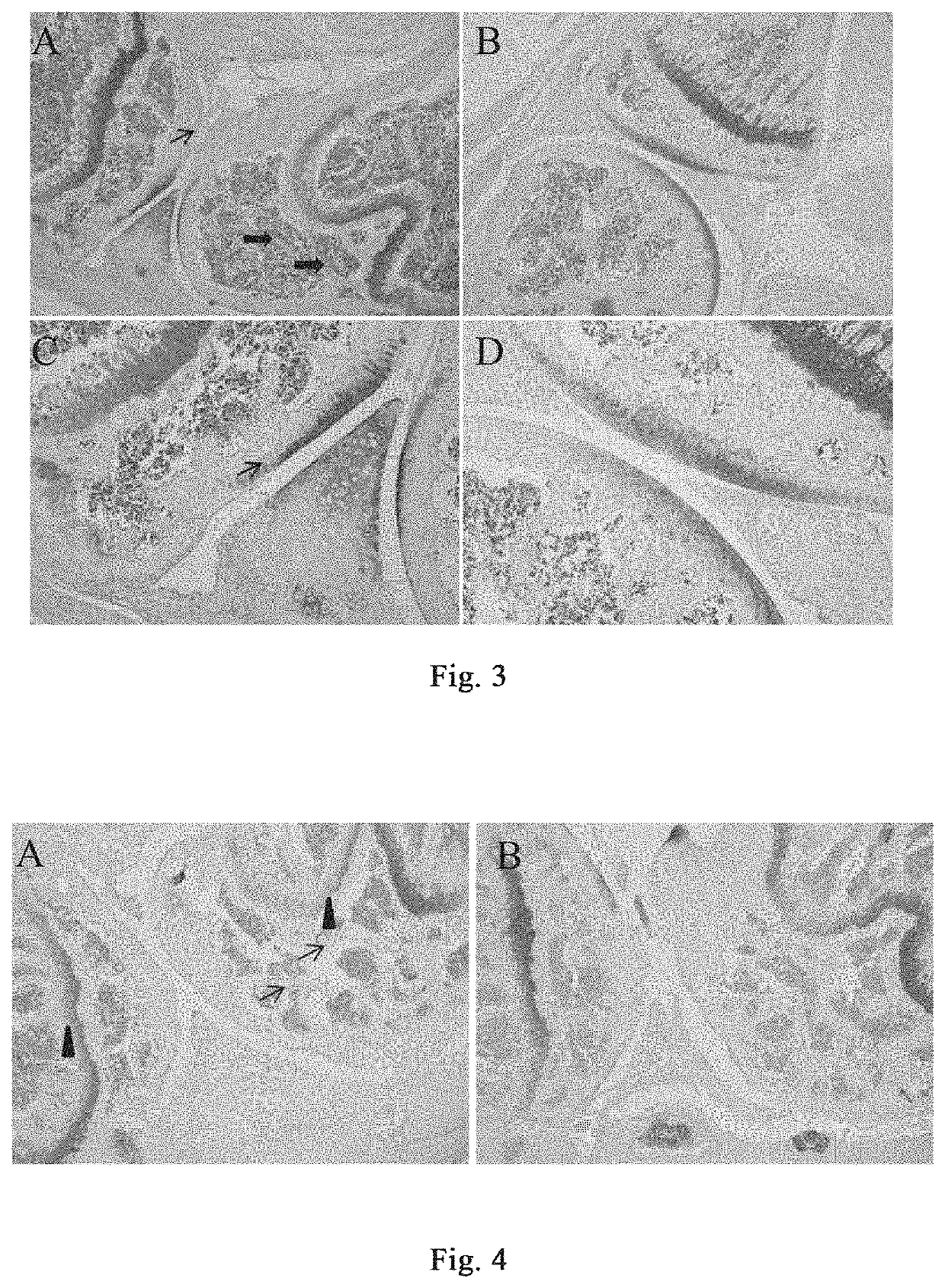 Method and drug for preventing or treating osteoarthritis