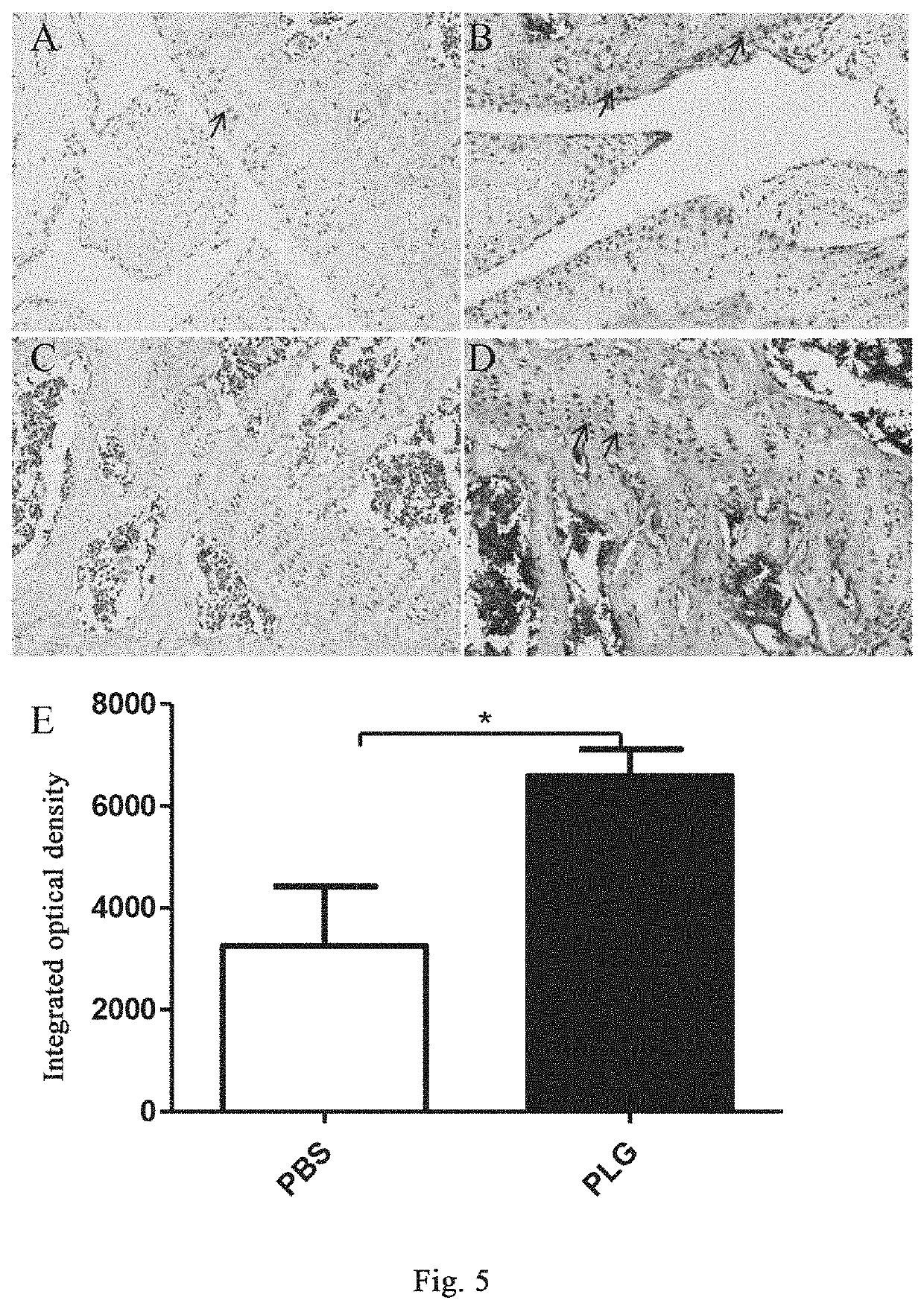 Method and drug for preventing or treating osteoarthritis