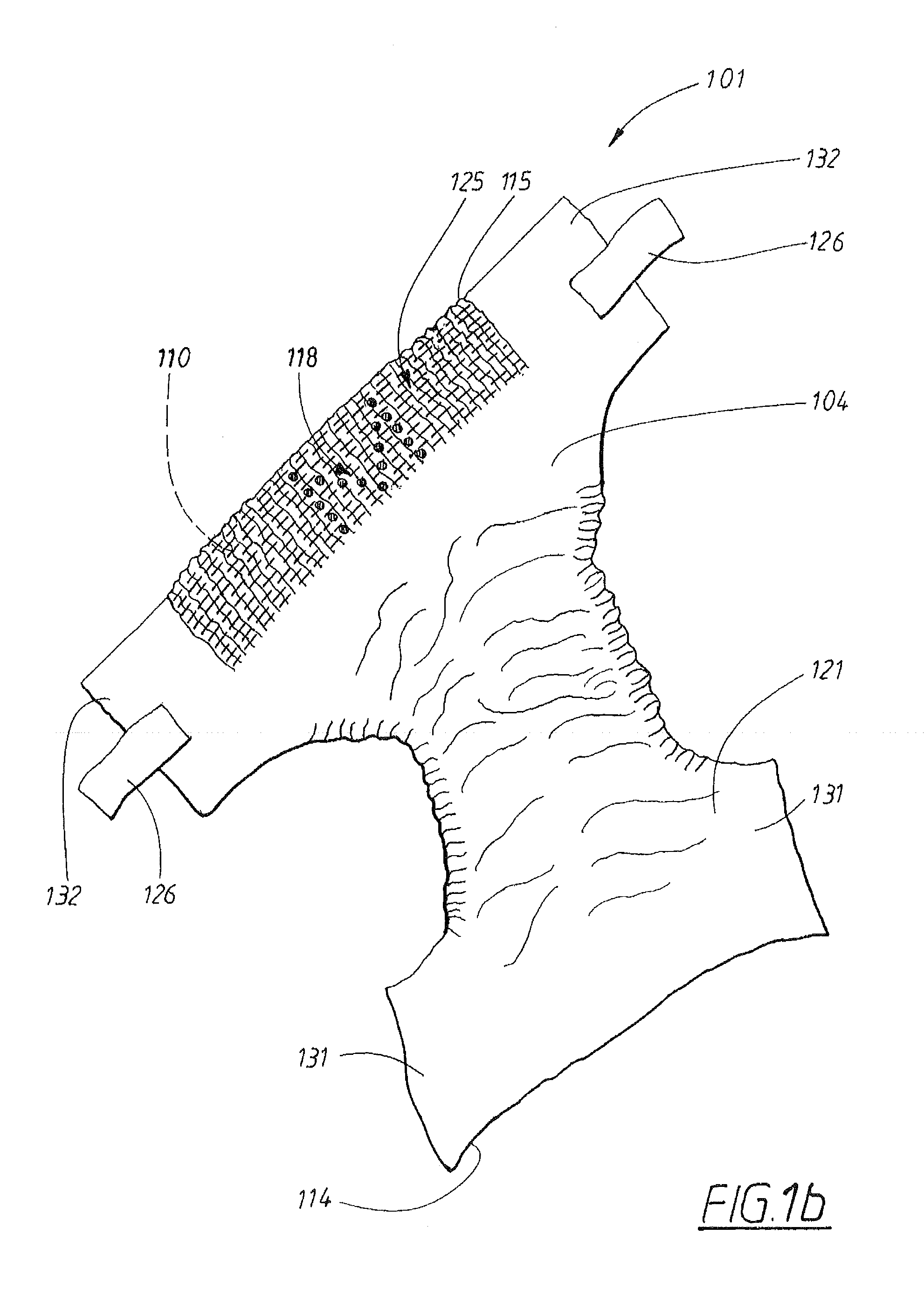 Absorbent article comprising one or several patterns