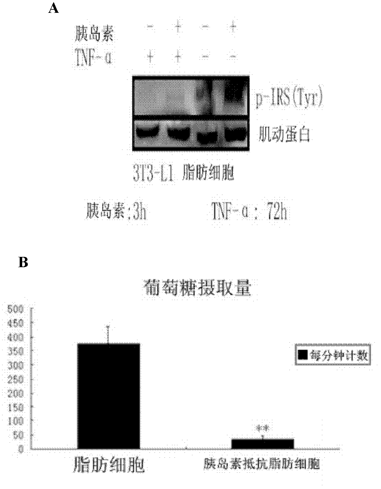 Application of geranylgeranyl diphosphate synthase (GGPPS) antagonist in preparation of medicament for treating II-type diabetes mellitus