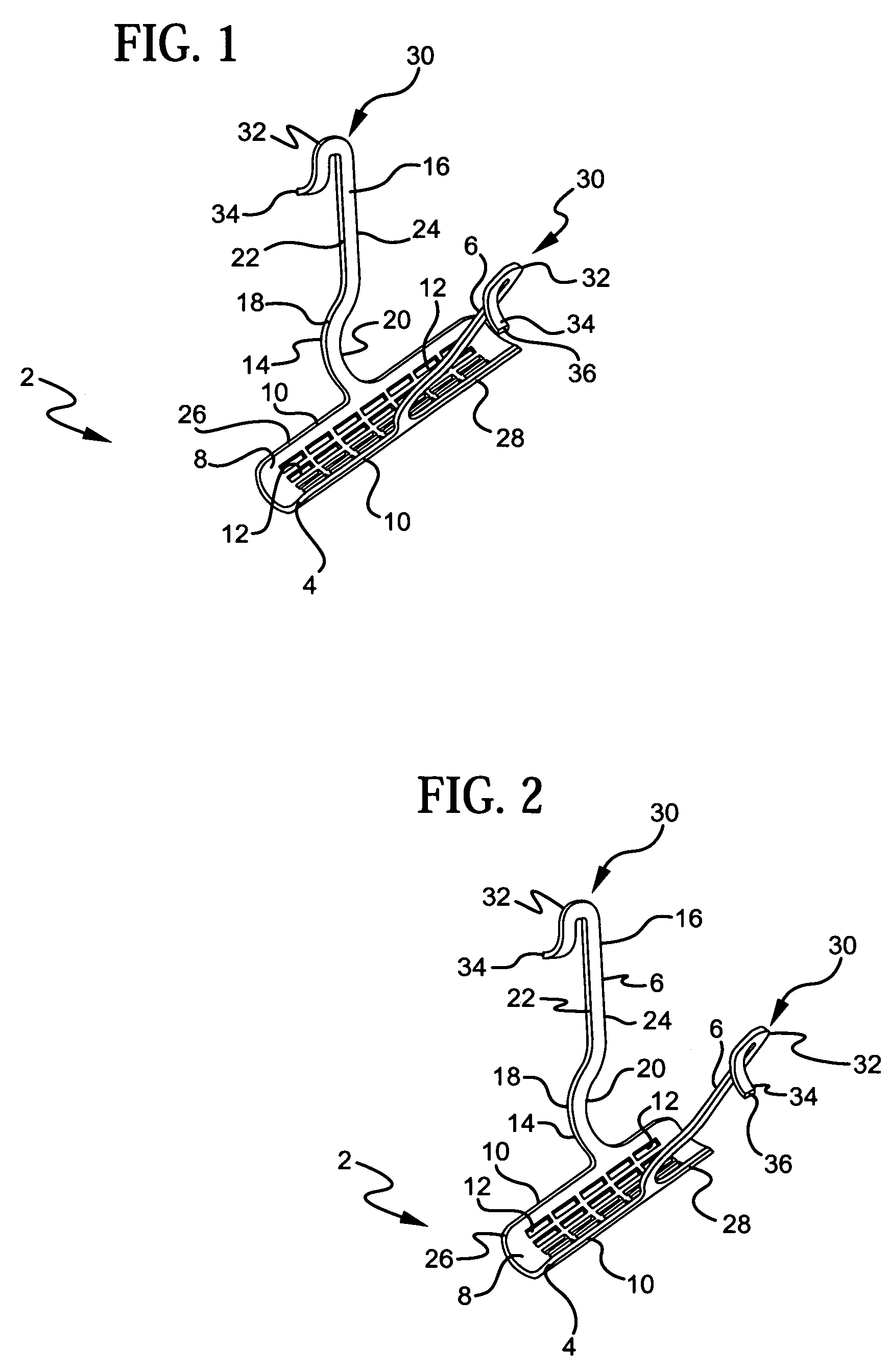 Stress urinary incontinence implant and device for deploying same