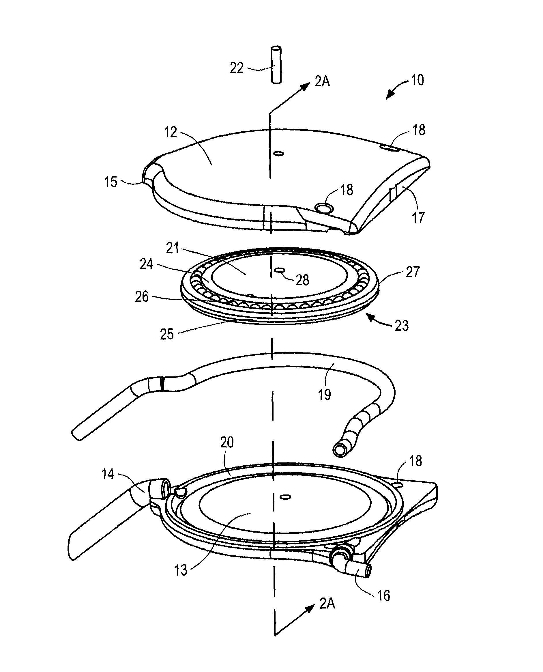 Apparatus and methods for treating excess intraocular fluid
