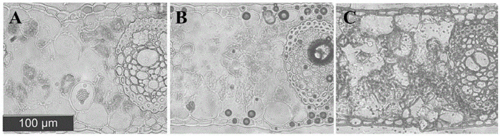 A cryosection method suitable for rapid observation of oil palm leaf anatomy