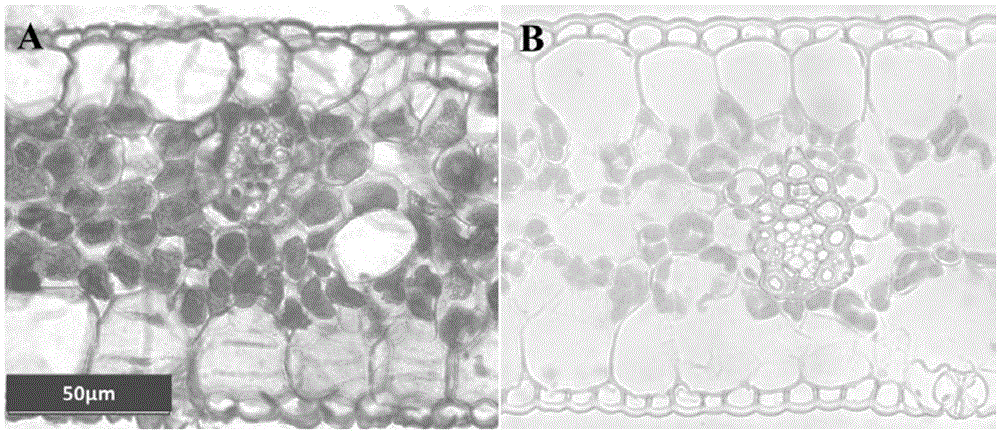 A cryosection method suitable for rapid observation of oil palm leaf anatomy