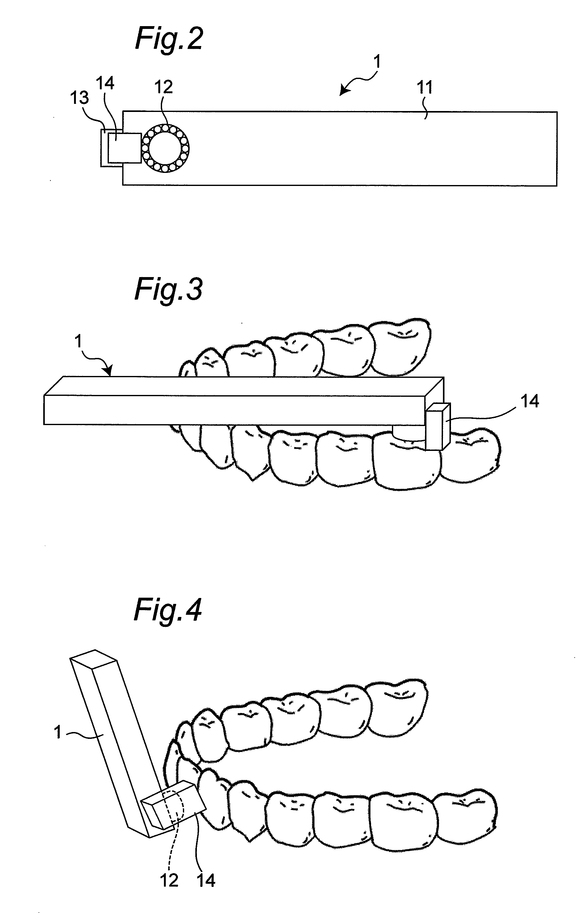 Intra-oral measurement device and intra-oral measurement system