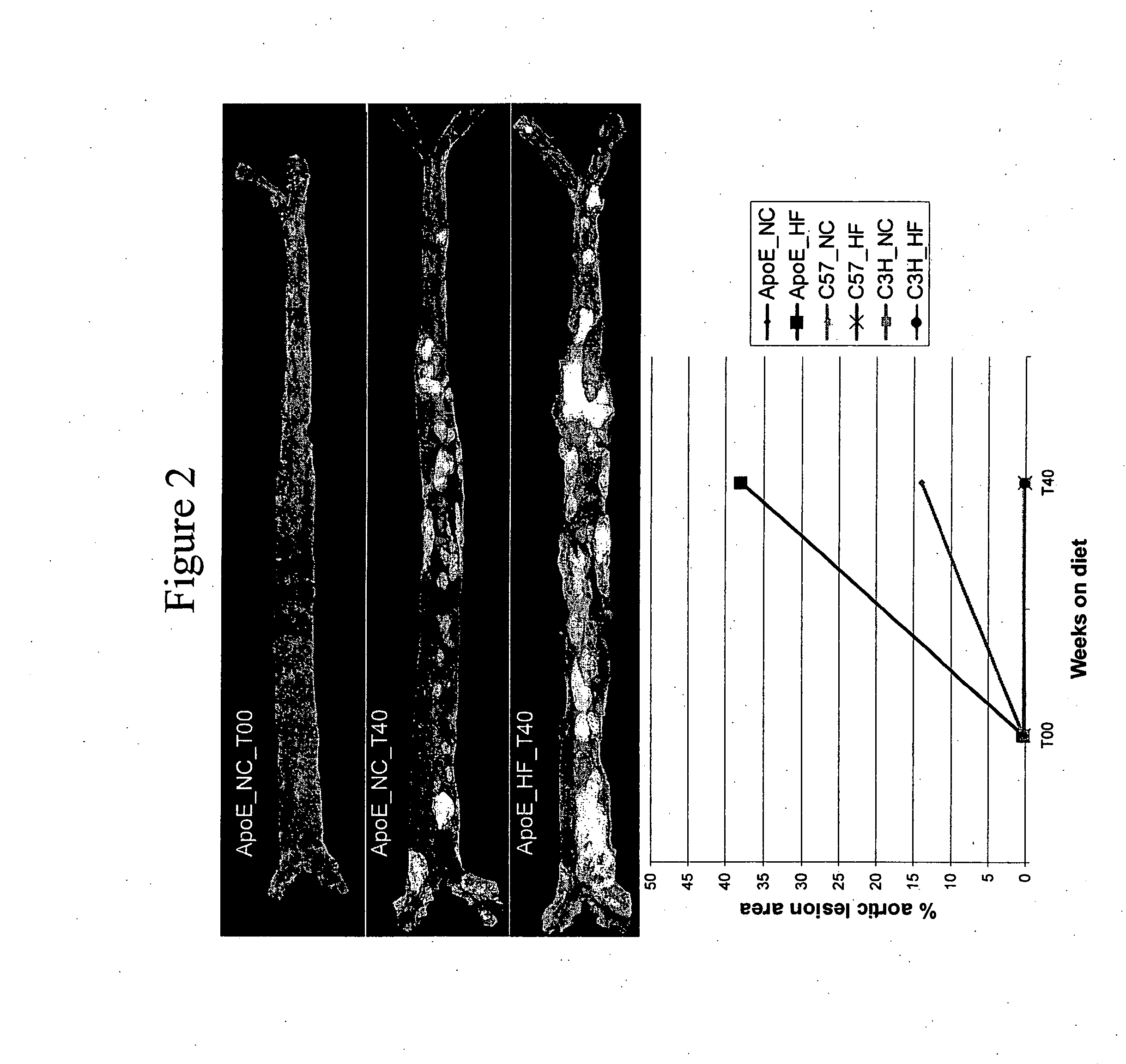 Methods and compositions for diagnosis, monitoring and development of therapeutics for treatment of atherosclerotic disease