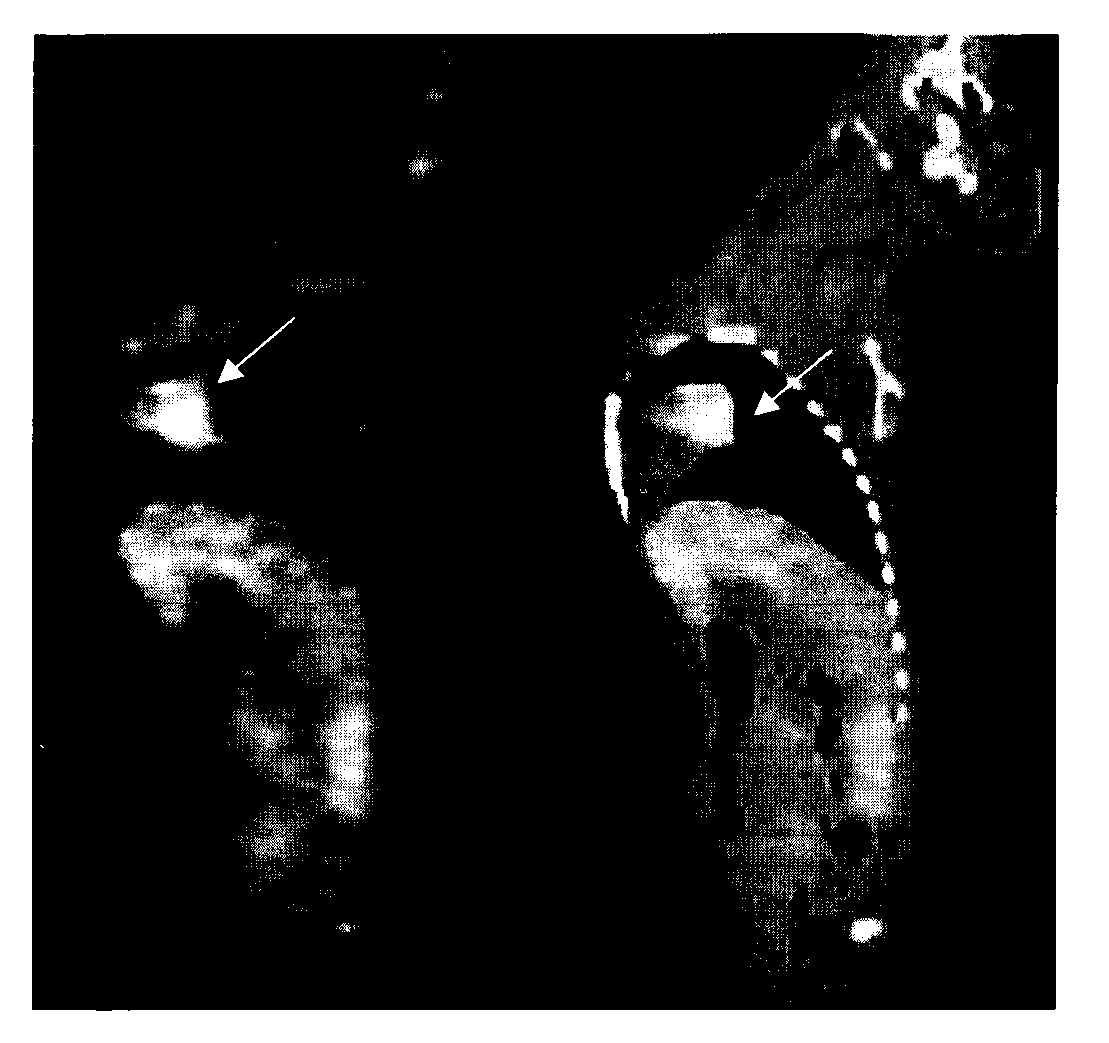 Cell apoptosis imaging medicament 68Ga-NOTA-Duramycin and preparation method thereof