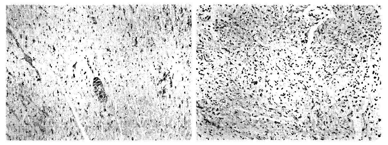 Cell apoptosis imaging medicament 68Ga-NOTA-Duramycin and preparation method thereof