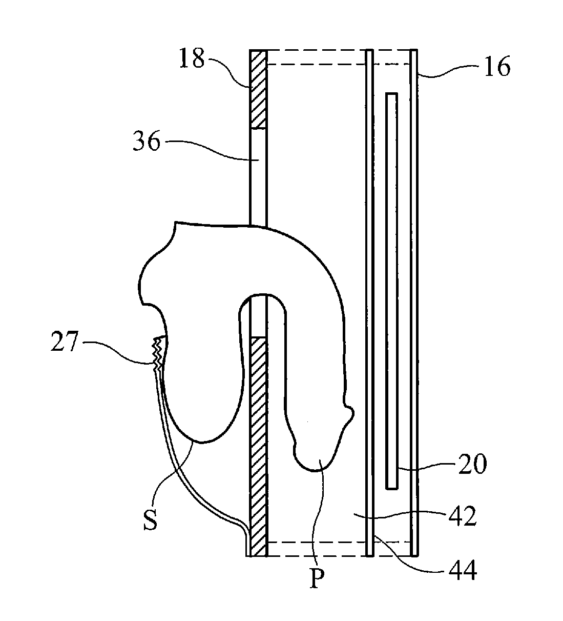 Incontinence device for ambulatory males