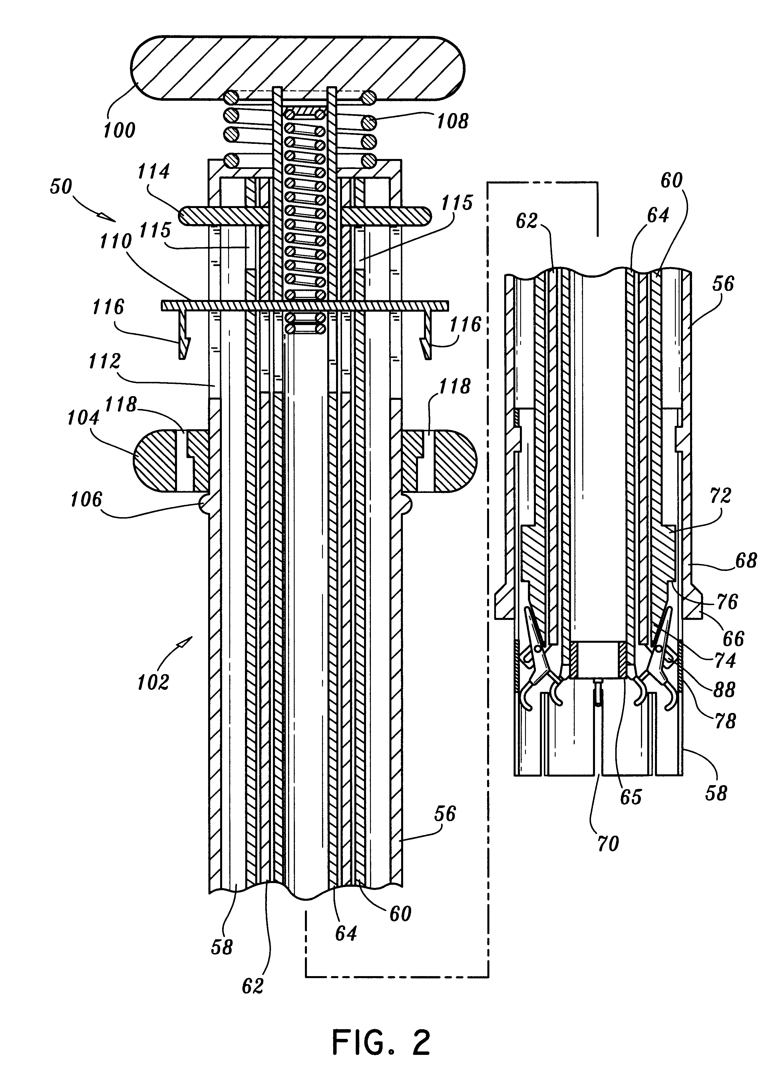Stapling apparatus and method for heart valve replacement