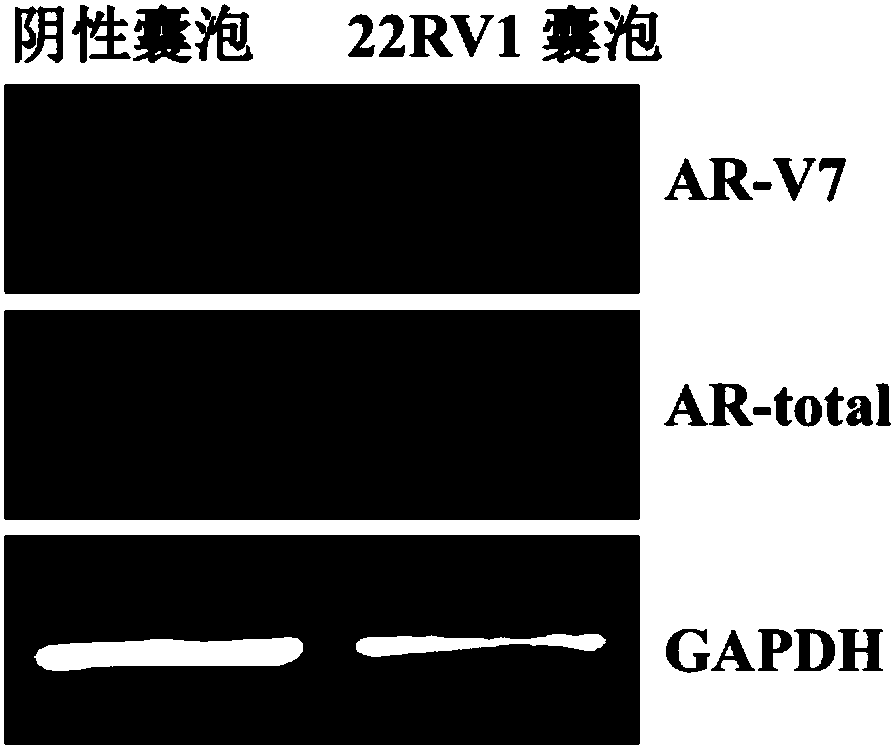 Primer and probe for detecting AR-V7 and AR in vesicle based on qPCR or digital PCR technology