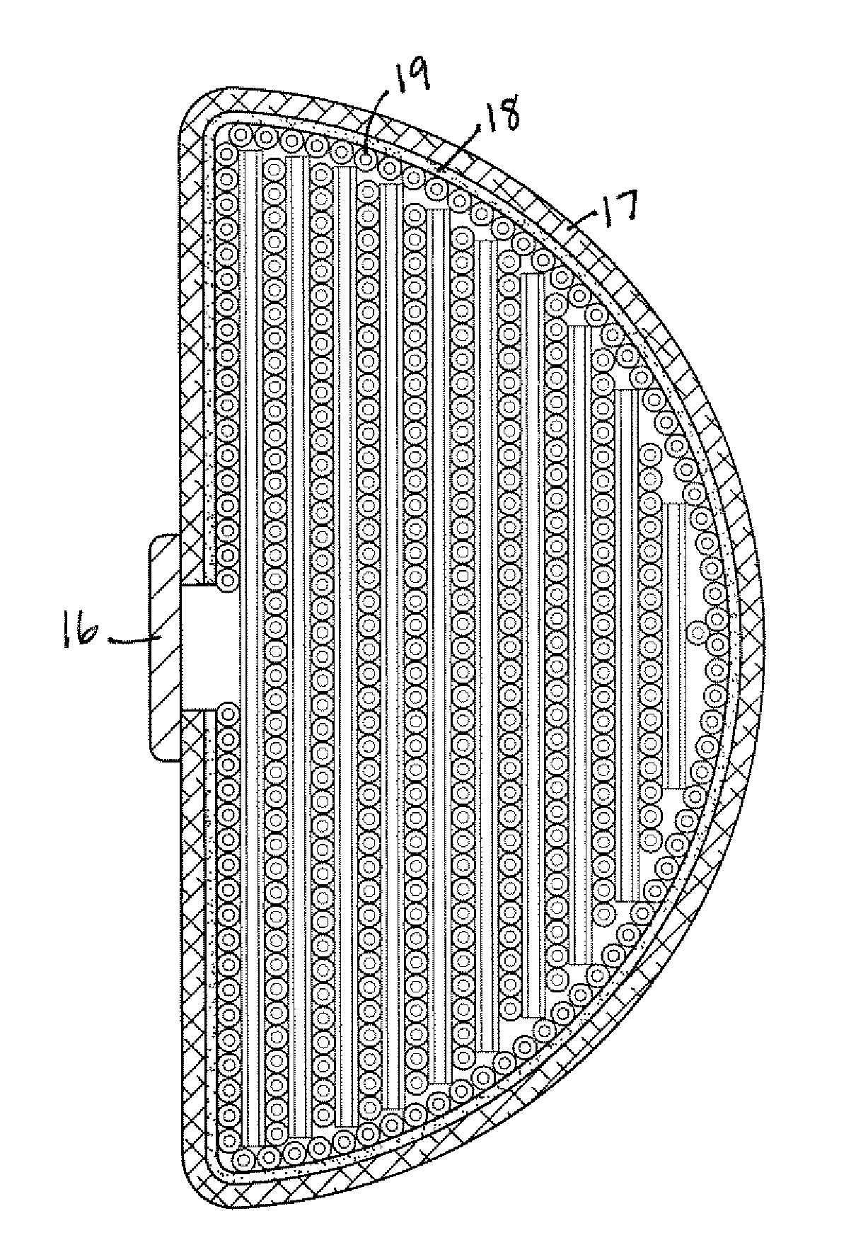 Breast Implants and Methods of Manufacture