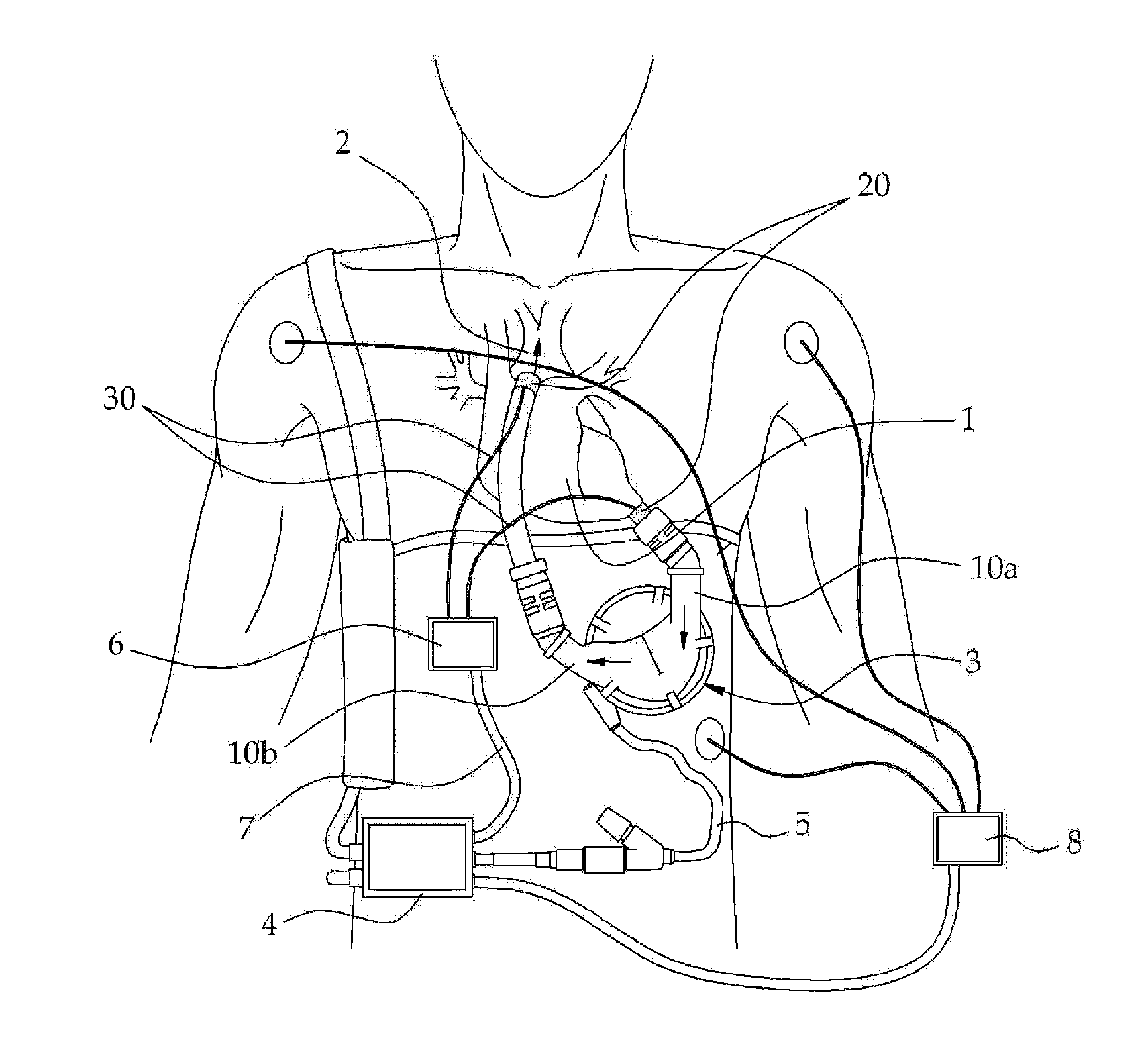 Ventricular assist device cannula and ventricular assist device including the same