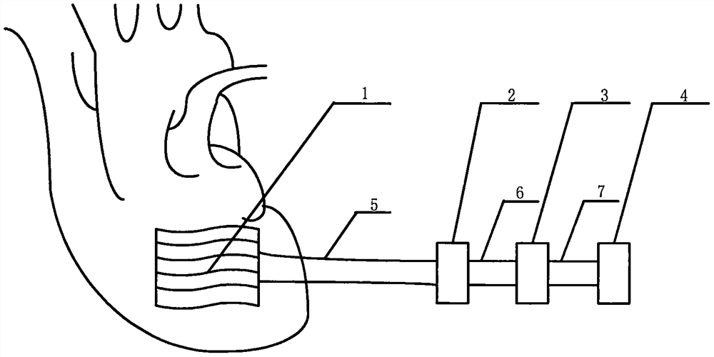 Heart micro-nano flexible power generation system